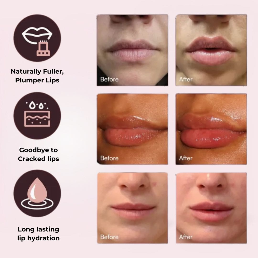 Lyvoro Lip Roller - My Store